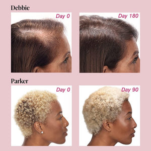 VIVISCAL - Promotes Existing Hair Growth ( 30 tablettes )