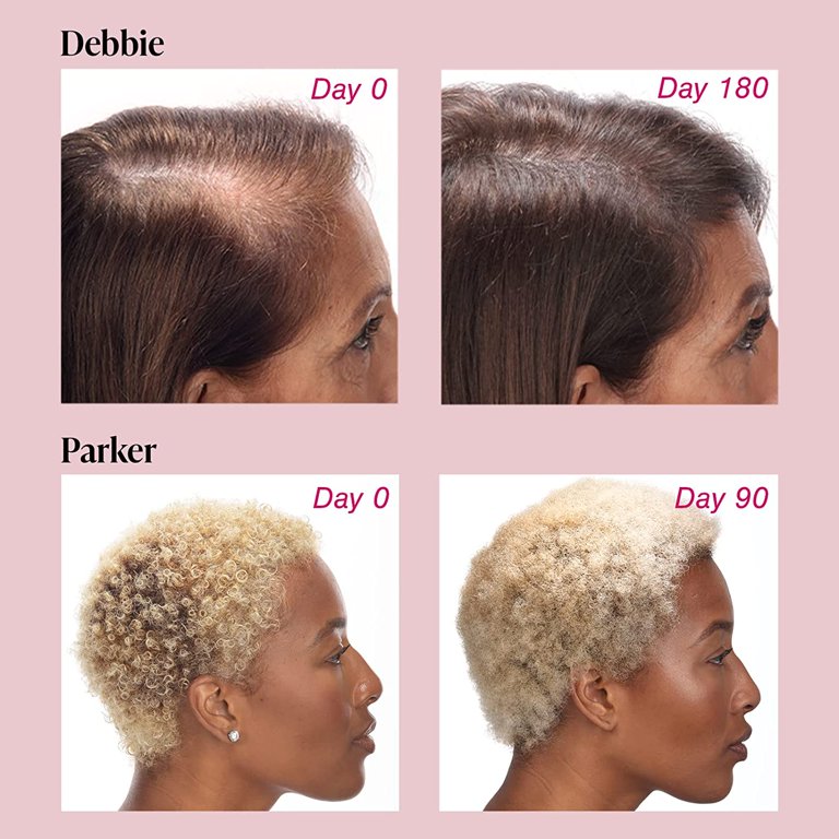 VIVISCAL - Promotes Existing Hair Growth ( 30 tablettes )