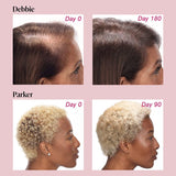 VIVISCAL - Promotes Existing Hair Growth ( 30 tablettes )