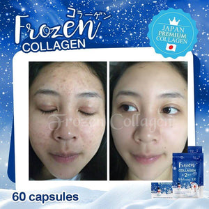 GLUTA FROZEN - Frozen Collagen 2 En 1 Blanchiment & Éclaircissement Naturellement X10 - 60 Capsules