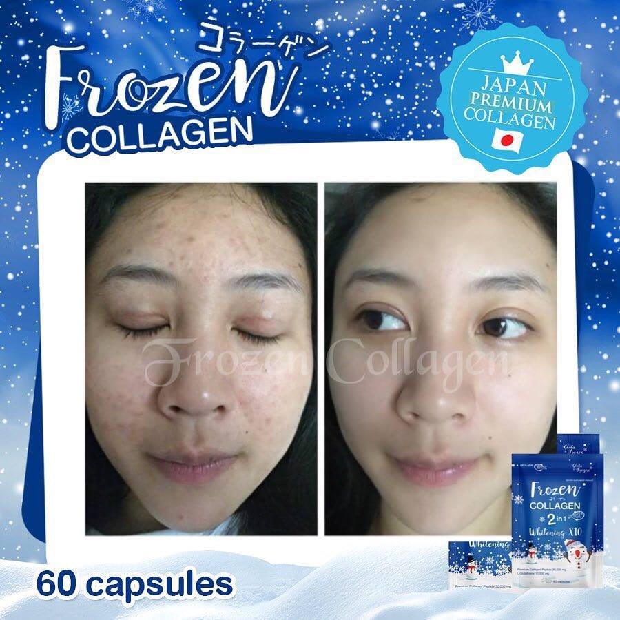 GLUTA FROZEN - Frozen Collagen 2 En 1 Blanchiment & Éclaircissement Naturellement X10 - 60 Capsules