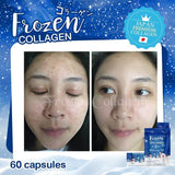GLUTA FROZEN - Frozen Collagen 2 En 1 Blanchiment & Éclaircissement Naturellement X10 - 60 Capsules