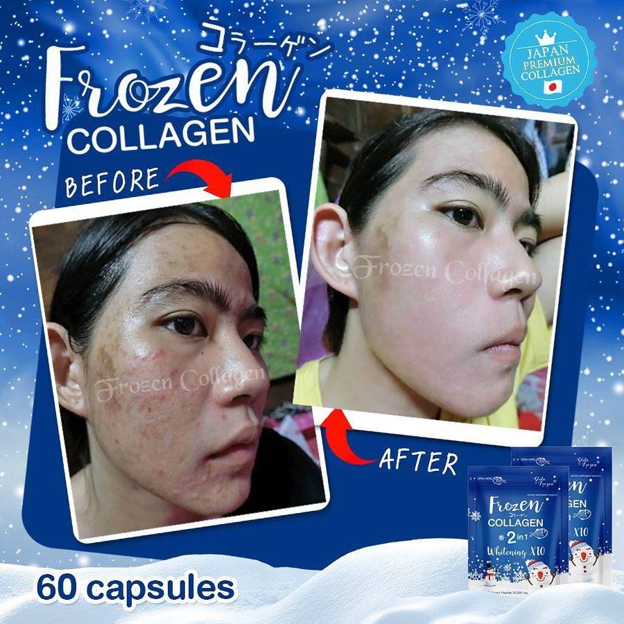 GLUTA FROZEN - Frozen Collagen 2 En 1 Blanchiment & Éclaircissement Naturellement X10 - 60 Capsules