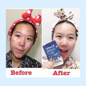 GLUTA FROZEN - Frozen Collagen 2 En 1 Blanchiment & Éclaircissement Naturellement X10 - 60 Capsules