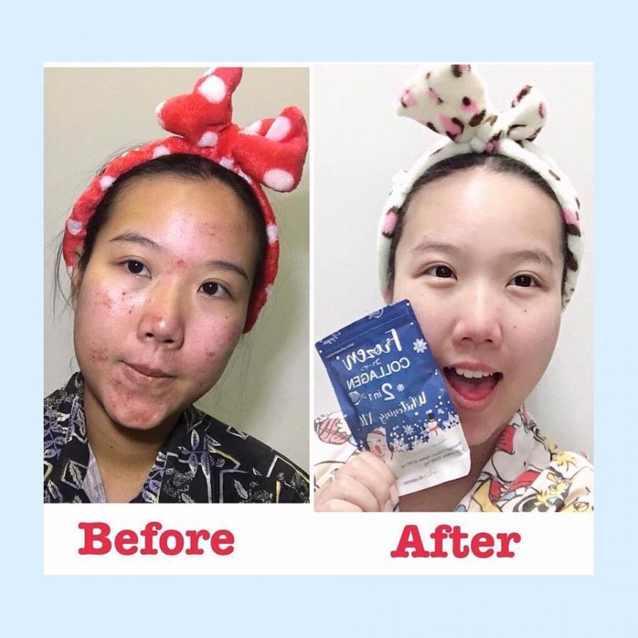 GLUTA FROZEN - Frozen Collagen 2 En 1 Blanchiment & Éclaircissement Naturellement X10 - 60 Capsules