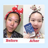 GLUTA FROZEN - Frozen Collagen 2 En 1 Blanchiment & Éclaircissement Naturellement X10 - 60 Capsules