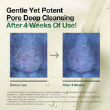 ANUA - DUO Double Cleansing 8 Hyaluronic Acid Foaming Cleanser + Heartleaf Pore Control Cleansing Oil Sensitive Skin - 150ml