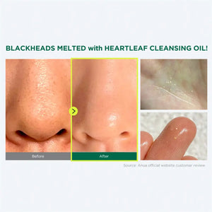 ANUA - Heartleaf Pore Control Cleansing Oil - 200ml