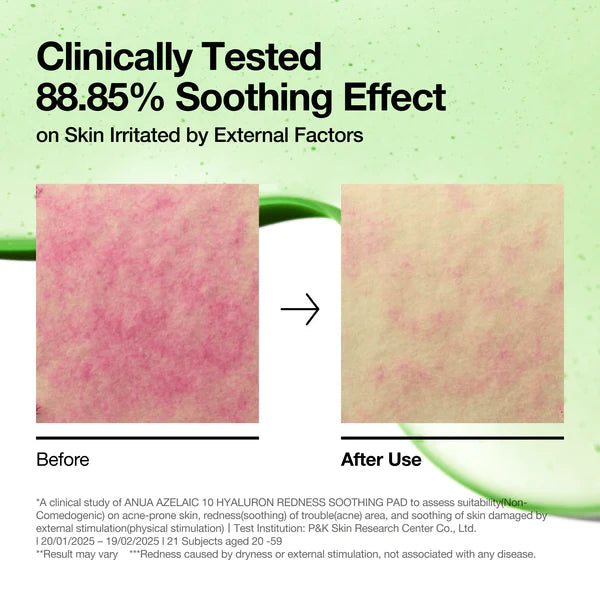 ANUA - Soothing Pad, Azelaic 10 + Hyaluron - 90 Pads