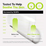 ANUA - Ultra-Thin Spot Cover Patch ( 75 patch )